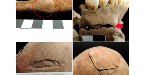 Croatian archaeologists have just unearthed a medieval grave containing decapitated and deformed remains — the victim of a chilling 'anti-vampire' ritual