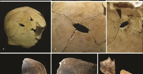 Horrific rituals or extreme starvation – the dark truth behind the dismembered corpses in Bronze Age mass graves!