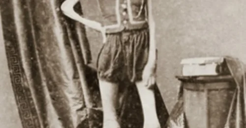 From Normal Boy to Living Skeleton: The Tragic Story of Isaac Sprague That Shocked America