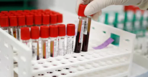 SHOCKING DISCOVERY: Scientists Discover NEW Blood Type - Only ONE Person on Earth Has It!
