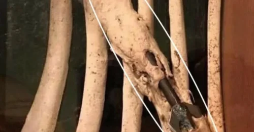 A Spear Pierced His Ribs—But What Happened Next Defied All Logic