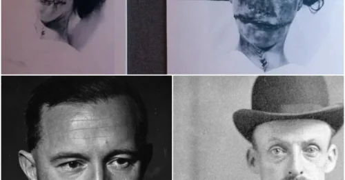 The Gruesome History of the Glasgow Smile - Behind the 'Glasgow Smile' are horrifying tales of torture and the most brutal violence in history, devised by Scotland's earliest gangs.