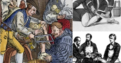 550 BC’s Horrifying Elite Rule: Only the Rich Could ORDER Amputations – The Untold Story!