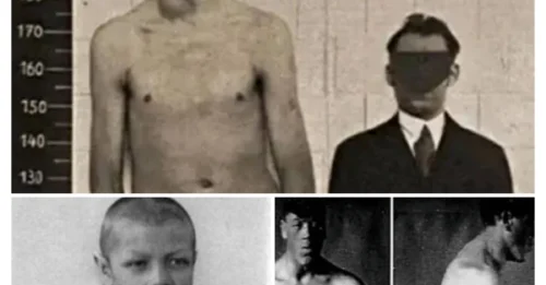 The Tragic Story Of Adam Rainer, The Man Who Went From Dwarf To Gian ...