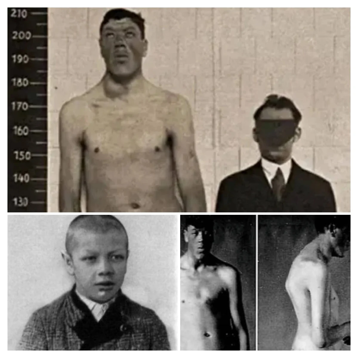 The Tragic Story Of Adam Rainer, The Man Who Went From Dwarf To Gian ...