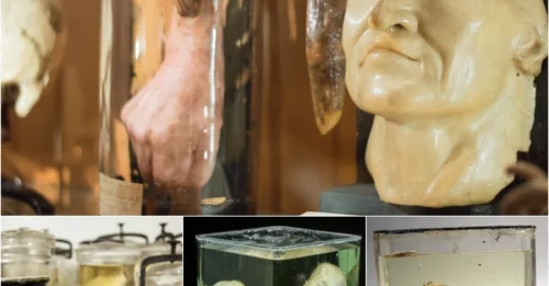 Shocking Secrets of The Mütter Museum Exposed: 25 Real Human Anomalies That Defy Science!