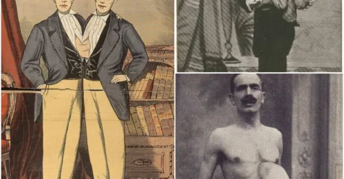 A Life of Horror: The Life Of Circus Performer Jean Libbera, The Man With A Parasitic Twin Growing Out Of His Torso
