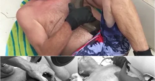 Nightmare Up Close: Man Gripped by Shark’s Jaws as Blood Fills the Water!