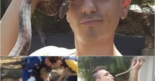 Teen Snake Catcher Battles Death After World's Deadliest Snake Bite!