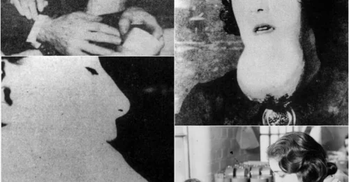 The Tragic Fate of the Radium Girls and the Dark Age of Radiation in the 1920s: How Radium Corporations Sacrificed Young, Beautiful Women for Profit HM