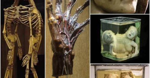 Inside The Mütter Museum Of Philadelphia, Where Some Of History’s Strangest Medical Oddities Are On Display