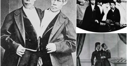 These conjoined twins fathered 21 children together – and their lives were more scandalous than you ever imagined!