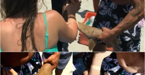 Shark vs. Human – The Brutal Bite That Didn’t End Even After Rescue!