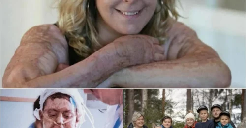 MOTHER'S INFERNO: Miracle Mom Survives 93% Burns After 5 Trips Into Inferno to Save Her Children