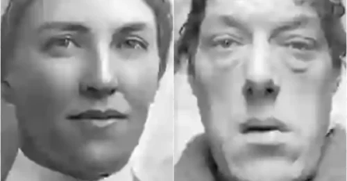 A Freak Medical Condition Gave Her a Second Face – The Unbelievable True Story