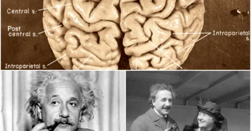 SHOCKING: The bizarre afterlife of Einstein’s brain — how it became science’s most controversial relic!
