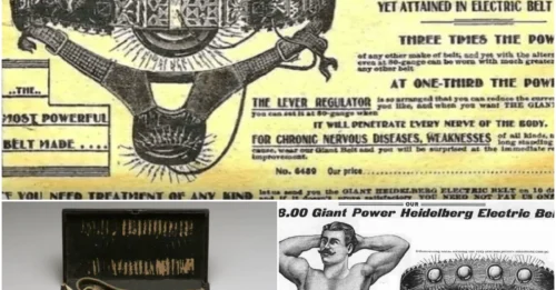 Medical World Stunned: Doctors Once Prescribed Self-Electrocution As A Miracle Cure For The Masses.
