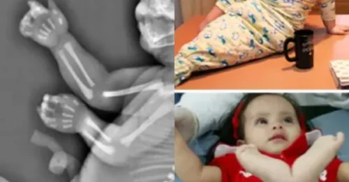 My Baby Was A Mermaid! Young Mum's Agonizing Decision After Bizarre Ultrasound Discovery Sends Shockwaves!
