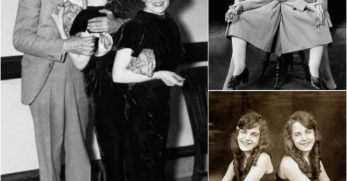THE FINAL, HORRIFYING TRAGEDY: The CRUEL Fate Of History's Most Famous Conjoined Twins