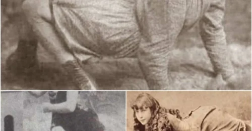 Startling Depictions of Mutants Walking Like Spiders in the 15th Century!