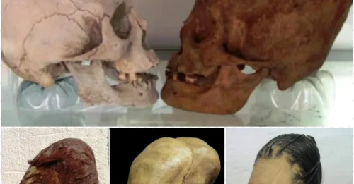 THEY LIED TO YOU FOR 100 YEARS: Those 'Alien' Elongated Skulls in Peru? Eye Sockets Just Got DNA-Tested – The Result Is More Disturbing Than Any Sci-Fi Movie