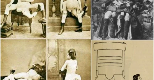 The SHOCKING Anatomy of Blanche Dumas: Born with THREE Legs, TWO Vaginas, and FOUR Breasts – Her Body PUBLICLY EXHIBITED in Freak Shows for Decades