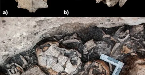 SHOCKING ARCHAEOLOGICAL DISCOVERY! A 5,300-Year-Old Skull Reveals the OLDEST Ear Surgery in Human History — The Patient Somehow SURVIVED the Agonizing Operation!