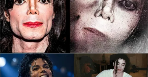 Inside The Horrific Death Of Michael Jackson: What The System Concealed As The Autopsy Uncovers The Naked Truth