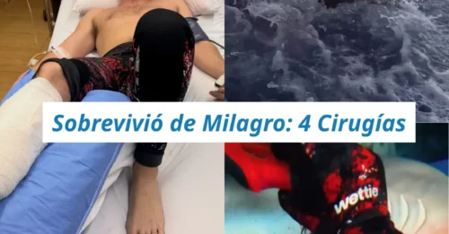 SOBREVIVIÓ DE MILAGRO: Sufrió el feroz ataque de un tiburón, requirió 4 cirugías y revela la lección que casi le cuesta la vida